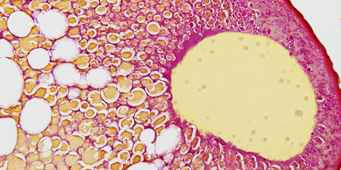 Cellekerne i en ægcelle fra europæisk ål. Foto: Michelle Jørgensen.